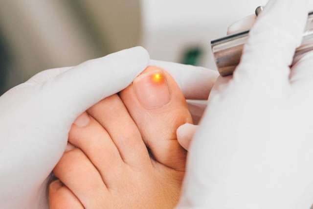 Foot healthcare professional treating a patient's ingrowing toe nails