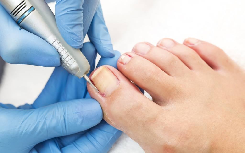 Foot healthcare professional giving a patient a medical pedicure